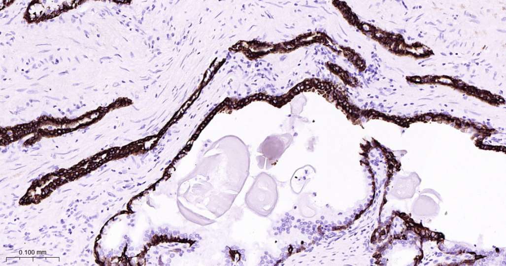 人Keratin 7即用型免疫组化试剂盒-IHC0604H